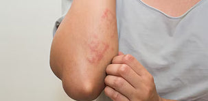 Symptom Image 6